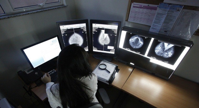 Inteligência artificial detecta câncer de mama com precisão semelhante à de médicos